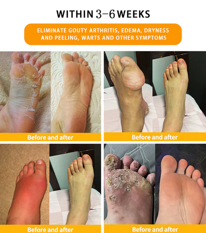 NESLEMY™ 30-Herb Slimming & Detox Foot Bath Beads-🦵👩‍⚕️(LANA Certification, Lymphatic Association of America)