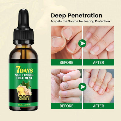 LOVILDS™ Ginger Nail Rescue Oil 🔥 | Natural Herbs 🌱🌱